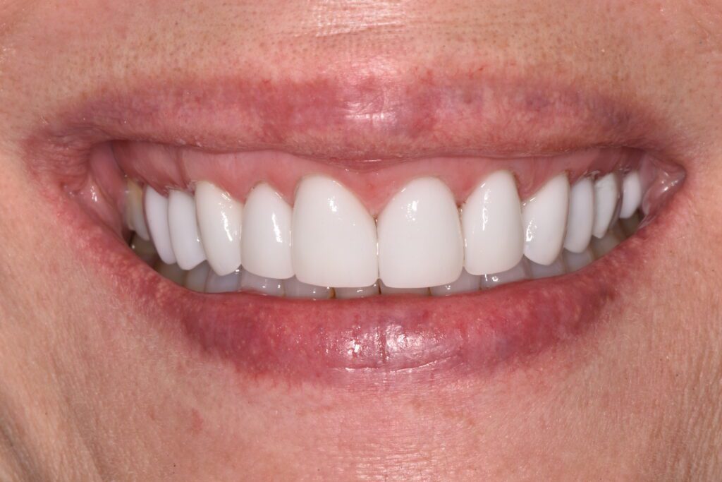 Viera Dental Arts | Dentist in Melbourne FL -