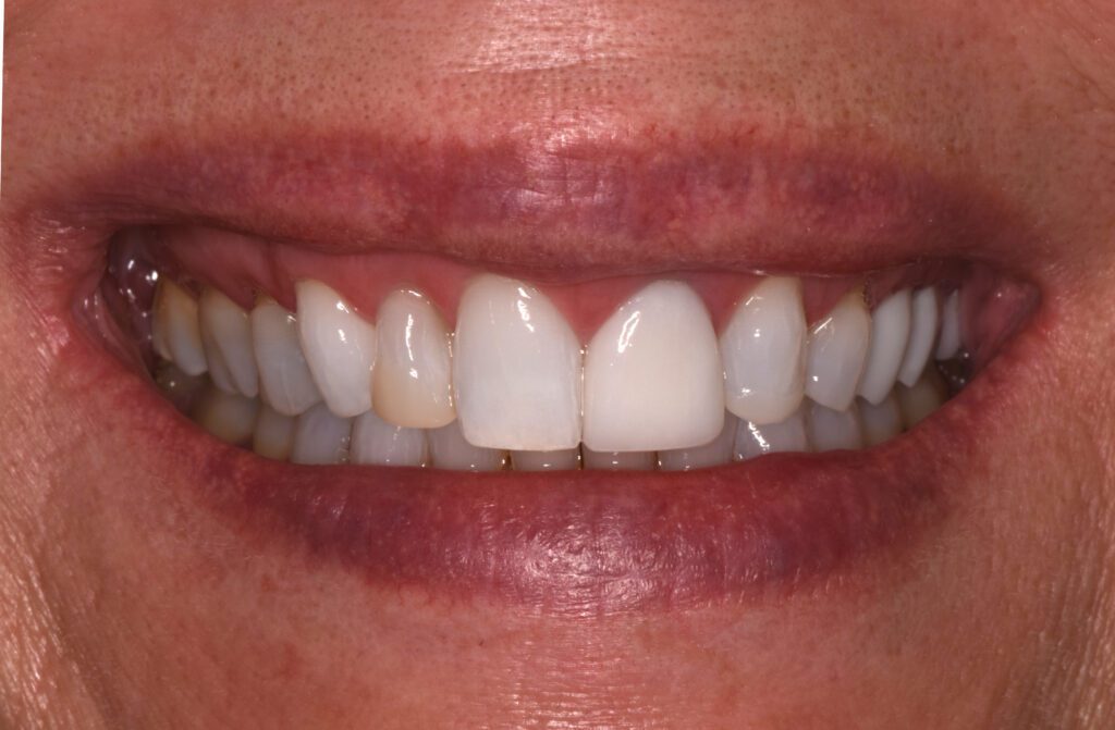 Viera Dental Arts | Dentist in Melbourne FL -